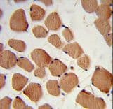 Polyclonal Rabbit anti-Human HACL1 Antibody (aa550-578, IHC, WB)