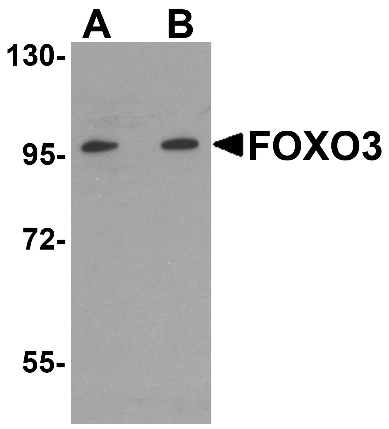 IHC-plus™ Polyclonal Rabbit anti-Human FOXO3 / FOXO3A Antibody (IHC, IF, WB)