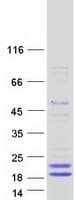 Human PLA2G10 Protein (Recombinant Myc-DDK (Flag))