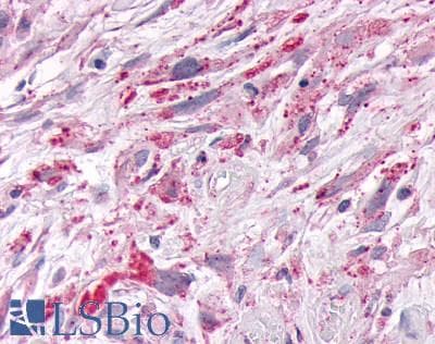 PathPlus™ NR1D1 Antibody (Internal)