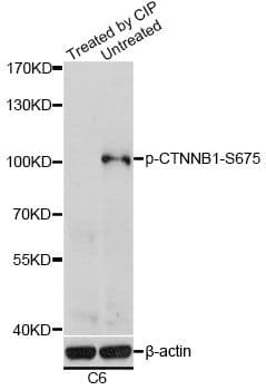 CTNNB1 / Beta Catenin Antibody (phospho-Ser675)