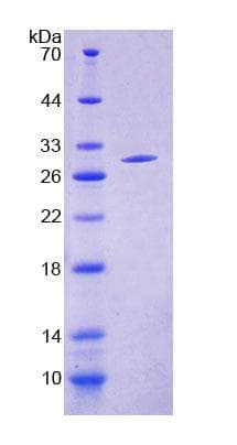 Human ACSM1 Protein (Recombinant His-T7, N-terminus)
