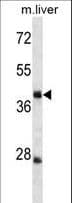 TRIM44 Antibody (aa298-327)
