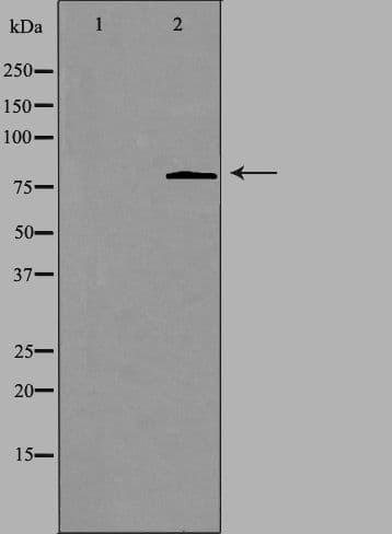 CHPF / CHSY2 Antibody