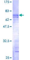 Human IGBP1 Protein (Recombinant GST)