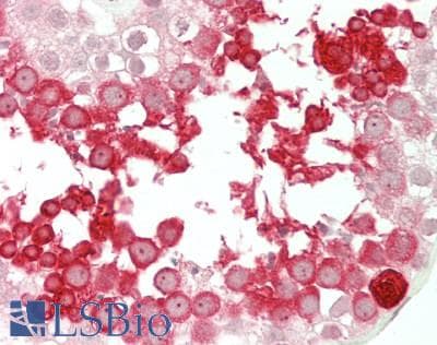 IHC-plus™ TSTA3 / GDP-L-Fucose Synthase Antibody (aa205-254)