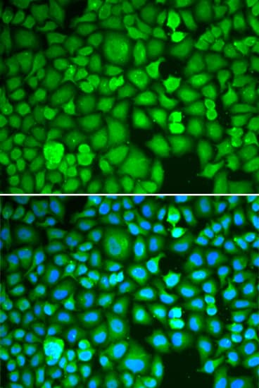 IHC-plus™ ETS1 / ETS-1 Antibody