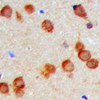 Polyclonal Rabbit anti-Human KDELR2 Antibody (Internal, IHC, IF, WB)