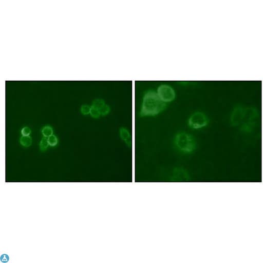 TYRO3 Antibody