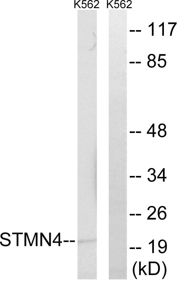 IHC-plus™ Polyclonal Rabbit anti-Human STMN4 / RB3 Antibody (aa140-189, IHC, WB)