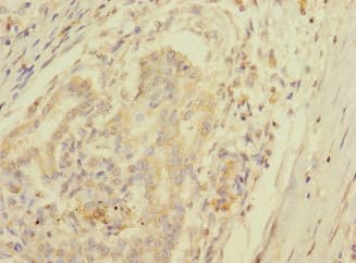SPC25 Antibody