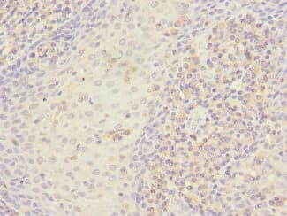 STX7 / Syntaxin 7 Antibody