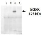 EGFR Antibody (phospho-Ser1045)