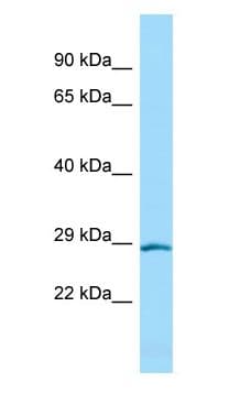 HOXD4 Antibody (N-Terminus)