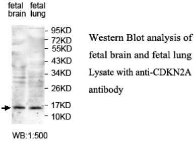 p16INK4a / CDKN2A Antibody (N-Terminus)