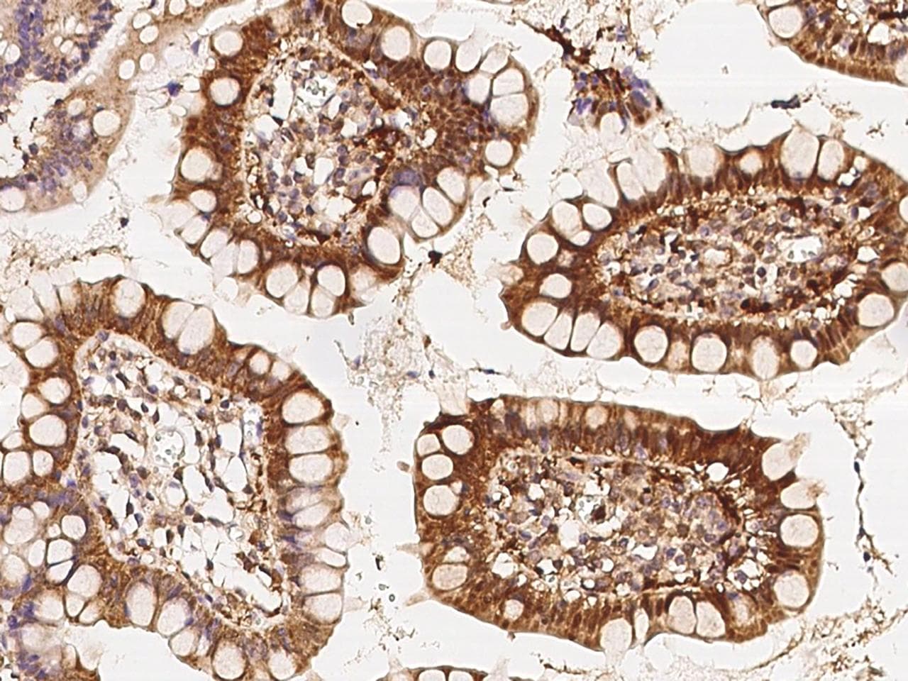 PLIN3 / M6PRBP1 / TIP47 Antibody