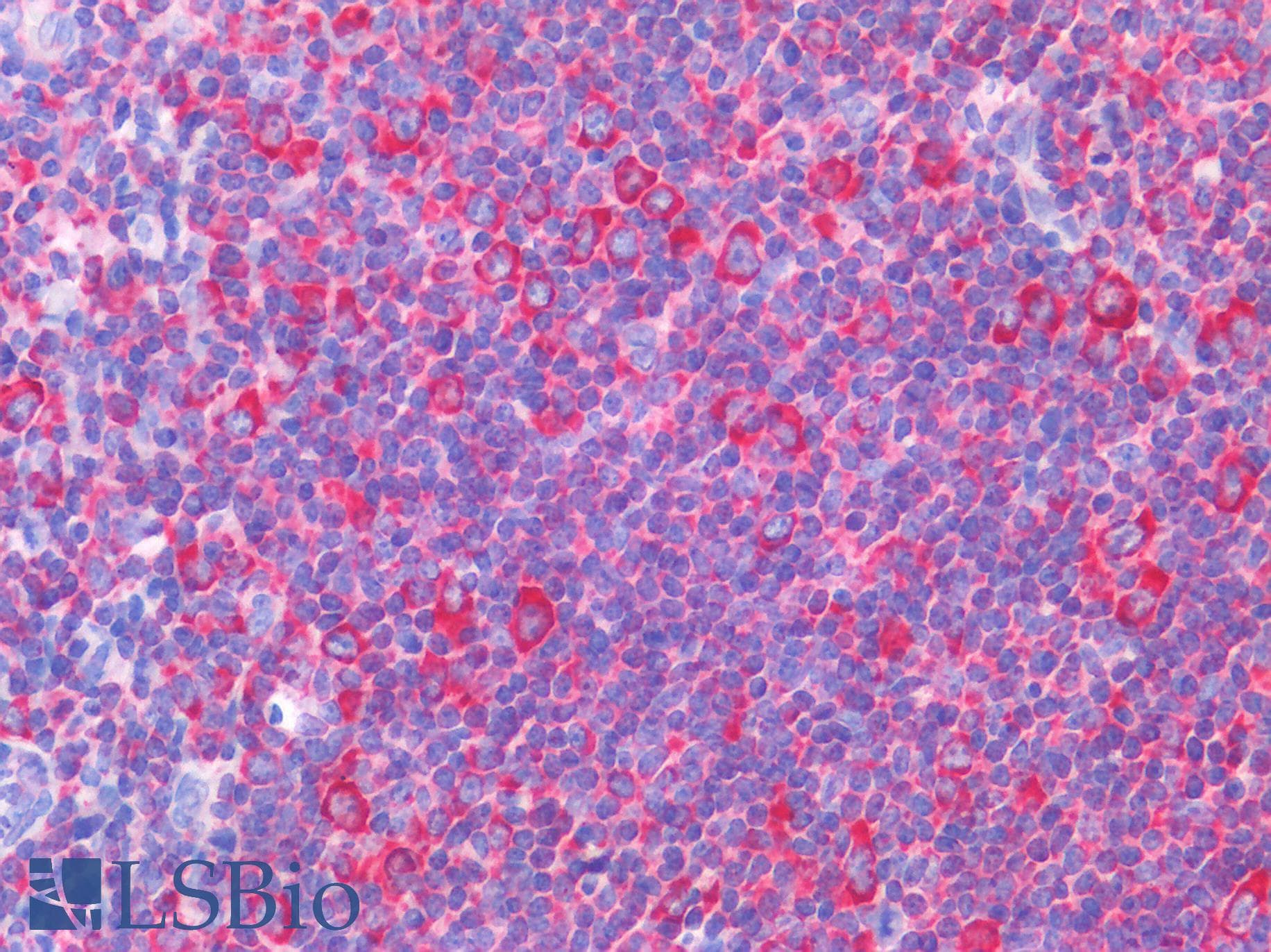 IHC-plus™ IL-1B / IL-1 Beta Antibody