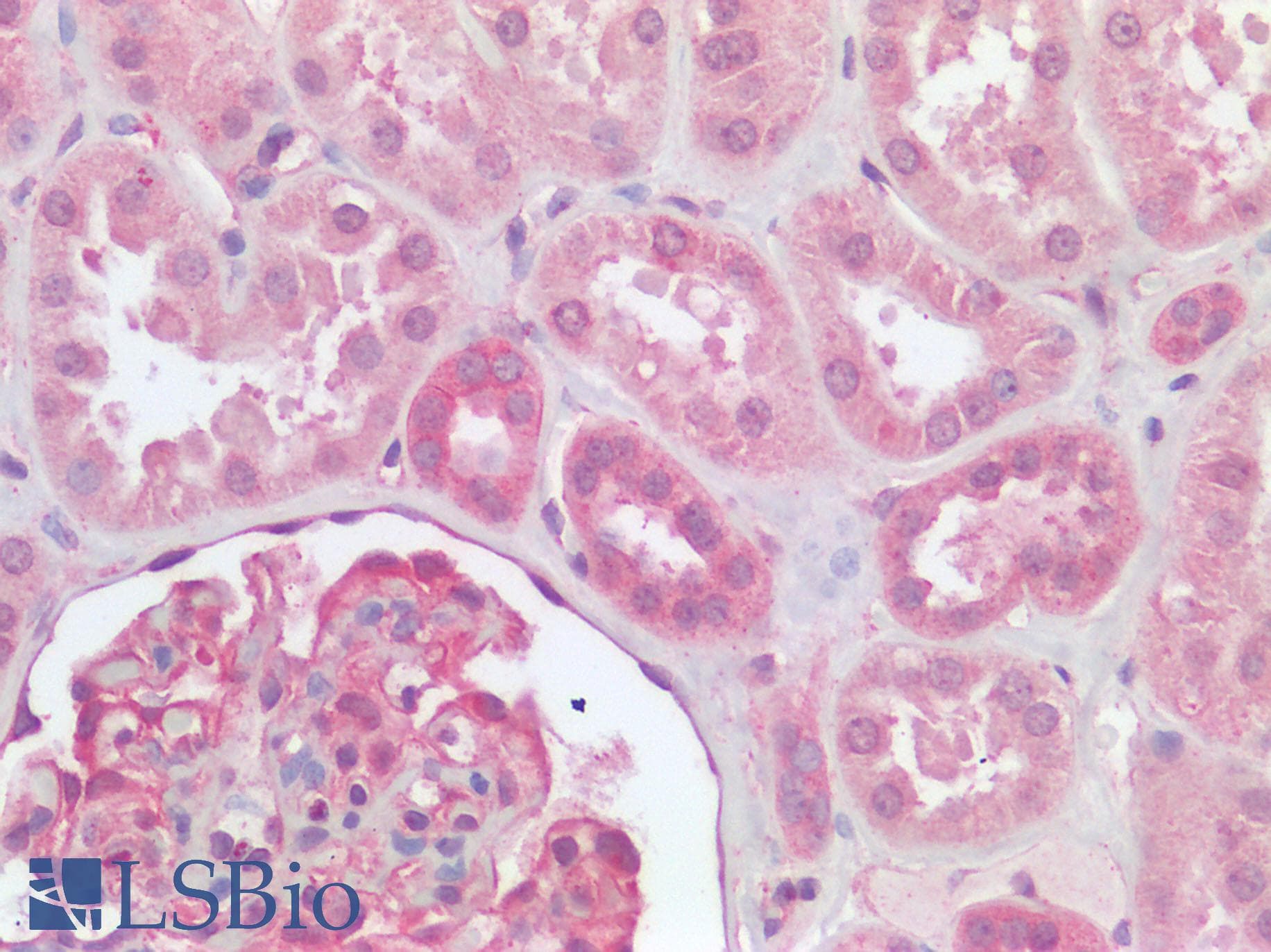 IHC-plus™ FURIN Antibody