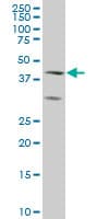 ELF3 / ESE1 Antibody (clone 1D8)