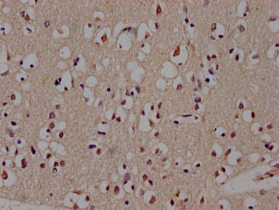 BCL11B Antibody