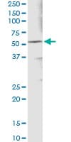 Monoclonal Mouse anti-Human ALDH3A1 Antibody (clone 2G4)