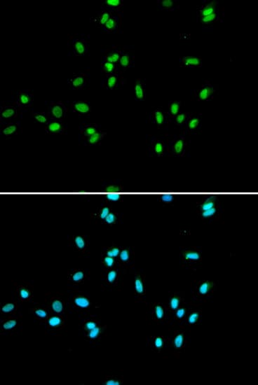 NR5A2 / LRH-1 Antibody