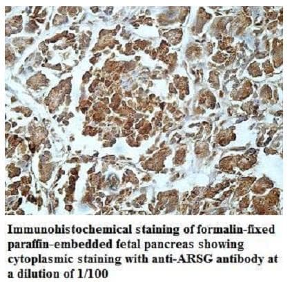 Polyclonal Rabbit anti-Human ARSG / Arylsulfatase G Antibody (aa138-335, IHC)