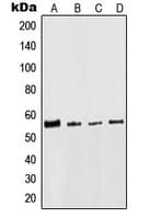 PathPlus™ Polyclonal Rabbit anti-Human KRT8 / CK8 / Cytokeratin 8 Antibody (C-Terminus, IHC, IF, WB)