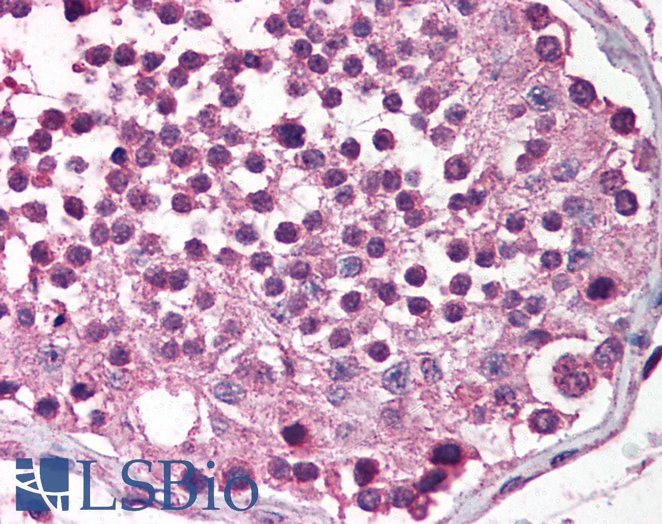 IHC-plus™ Polyclonal Rabbit anti-Human DENN / MADD Antibody (IHC, IF, WB)