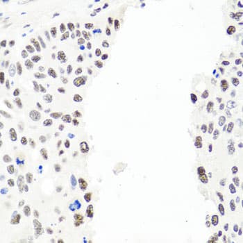 EXO1 Antibody