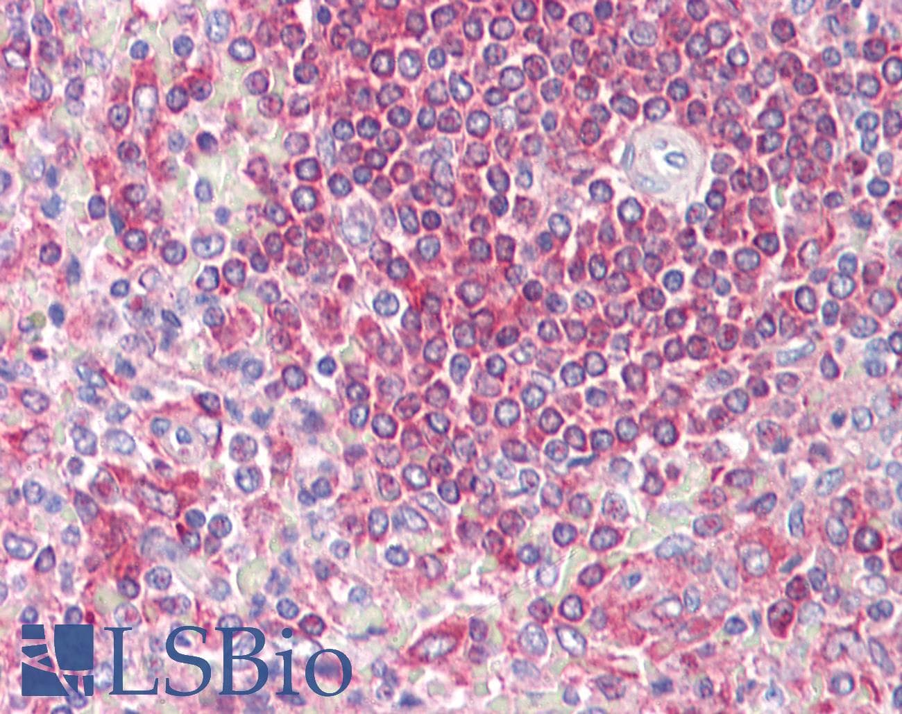 IHC-plus™ Polyclonal Rabbit anti-Human SNX2 Antibody (aa120-170, IHC, WB)
