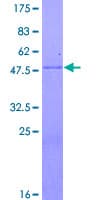 Human FOLR1 / Folate Receptor Alpha Protein (Recombinant GST)