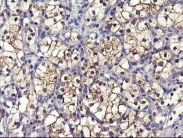 GSTO2 Antibody (clone OTI3A9)
