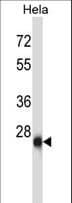 ZIC4 Antibody (aa1-30)