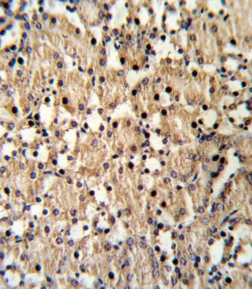 Polyclonal Rabbit anti-Human PAX8 Antibody (aa285-313, IHC, WB)