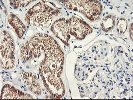 PDSS2 / DLP1 Antibody (clone OTI2A3, Carrier-free)