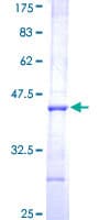 Human AADAC Protein (Recombinant GST, N-terminus)