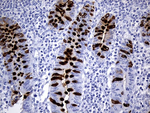 TFF3 / Trefoil Factor 3 Antibody (aa72-130, clone OTI5B2)