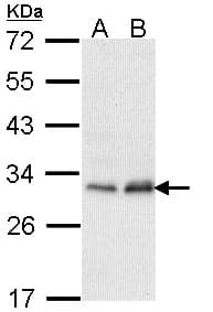 PMM2 Antibody