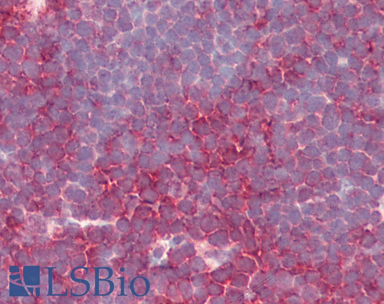 PathPlus™ PSENEN / PEN-2 Antibody