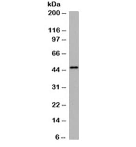 KRT18 / CK18 / Cytokeratin 18 Antibody (clone DE-K18)