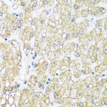 Polyclonal Rabbit anti-Human ATP5I Antibody (IHC, IF)