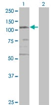 SMC3 / HCAP Antibody (clone 2F11)