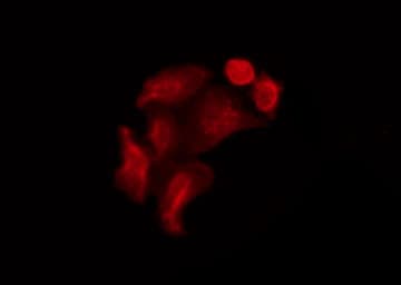 NOS1 / nNOS Antibody (phospho-Ser852)