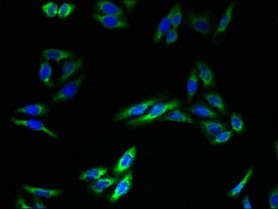 Polyclonal Rabbit anti-Human TMEM140 Antibody (IHC)
