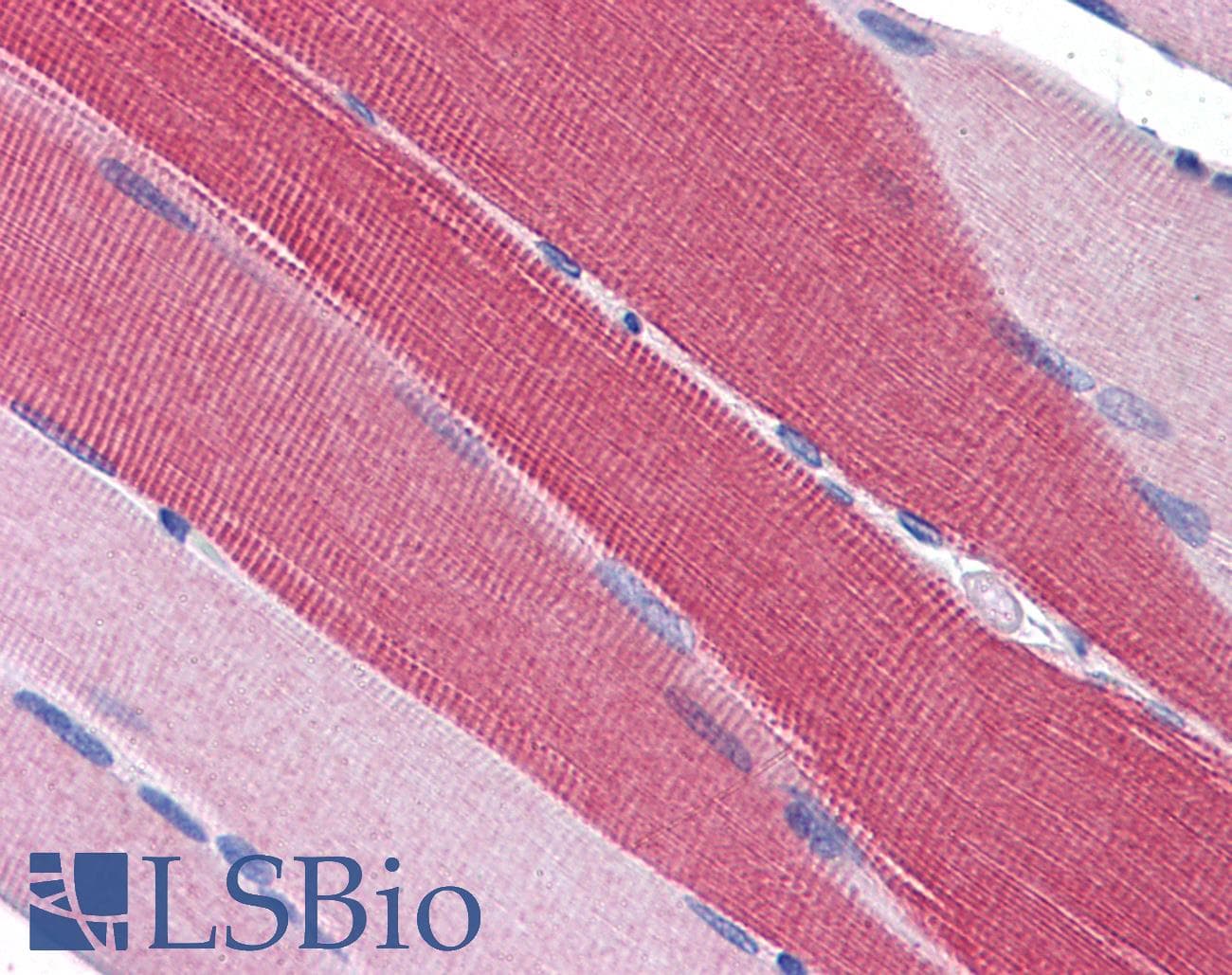 IHC-plus™ Polyclonal Goat anti-Human PDE4D Antibody (aa796-809, IHC, WB)