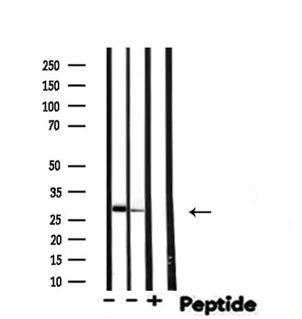 ALY / THOC4 Antibody