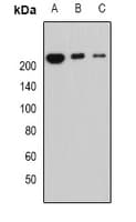 PPL / Periplakin Antibody