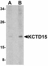IHC-plus™ KCTD15 Antibody
