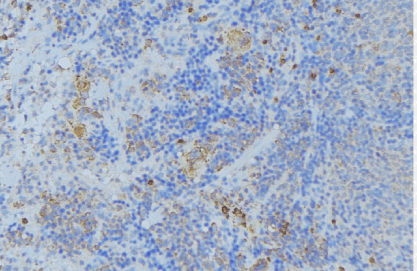 POSTN / Periostin Antibody